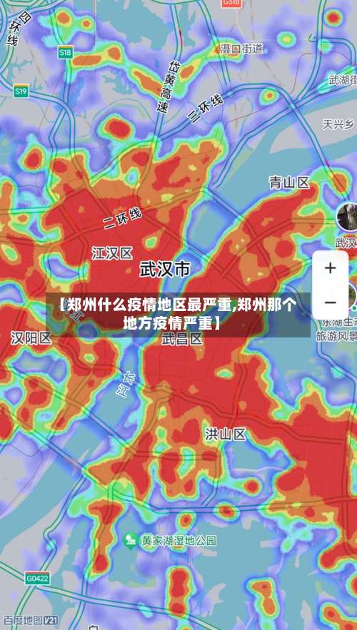 【郑州什么疫情地区最严重,郑州那个地方疫情严重】-第2张图片
