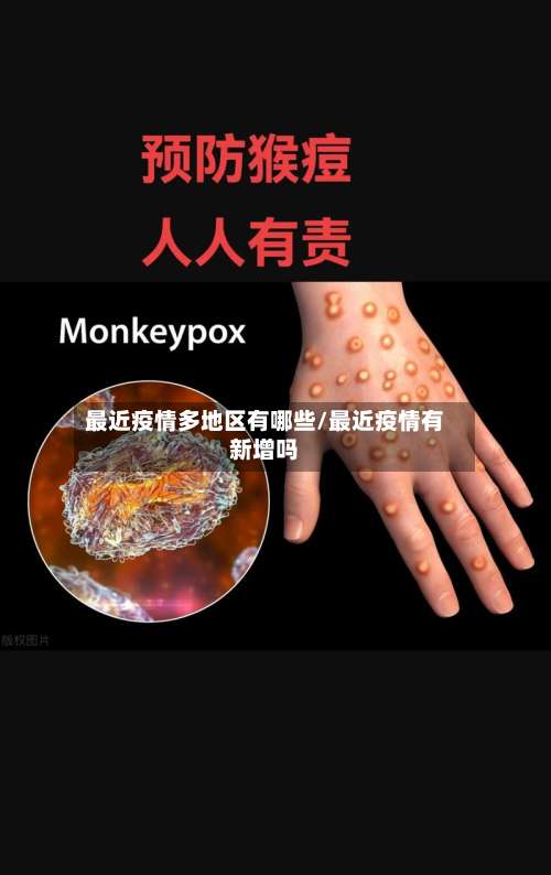 最近疫情多地区有哪些/最近疫情有新增吗-第2张图片